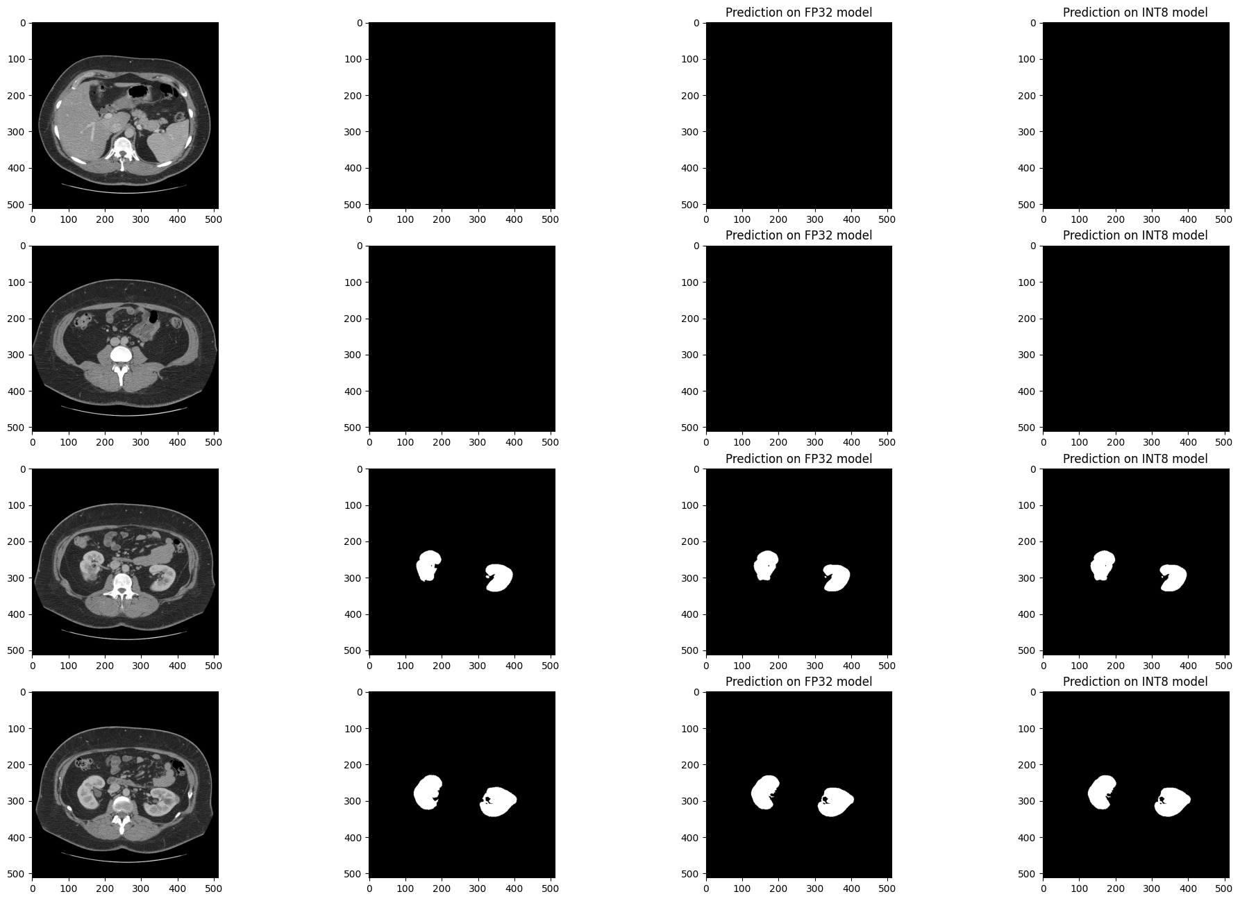 ../_images/110-ct-segmentation-quantize-nncf-with-output_37_1.png