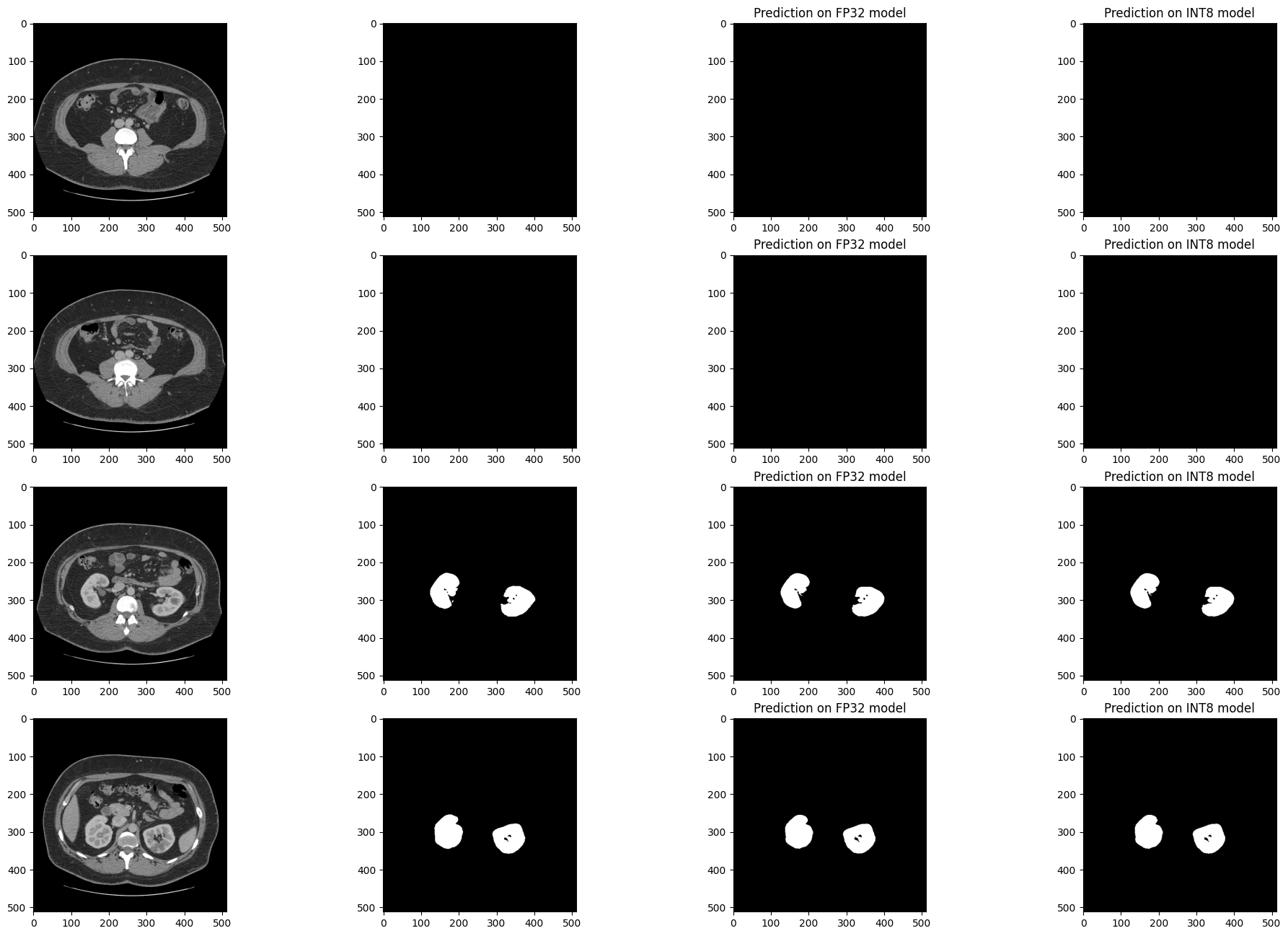../_images/ct-segmentation-quantize-nncf-with-output_37_1.png